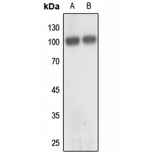 GLUR2 Rabbit Polyclonal Antibody
