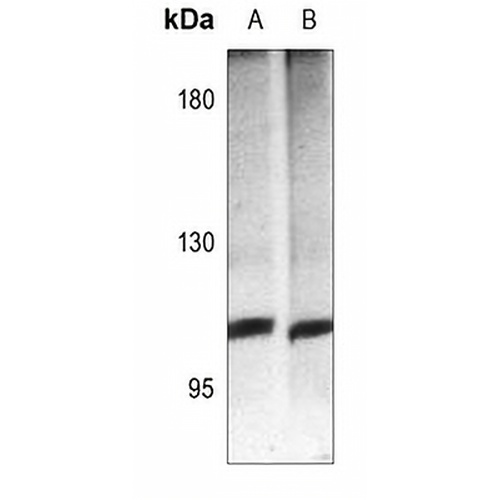 mGLUR4 Rabbit Polyclonal Antibody