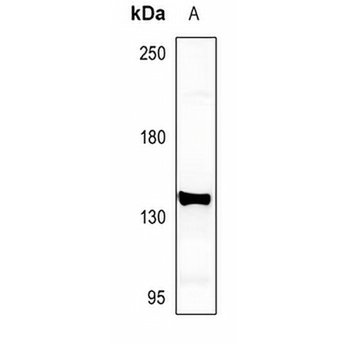 mGLUR5 Rabbit Polyclonal Antibody