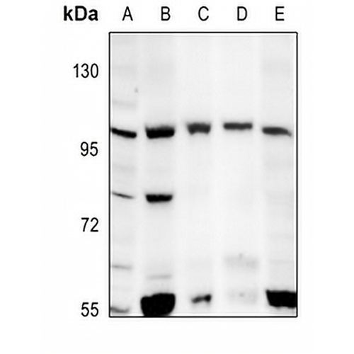 mGLUR6 Rabbit Polyclonal Antibody
