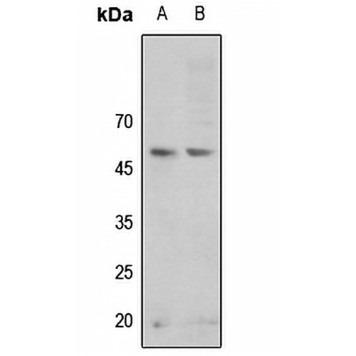 GSK3 alpha (Phospho-S21) Rabbit Polyclonal Antibody