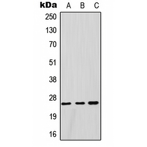 GSTM1 Rabbit Polyclonal Antibody