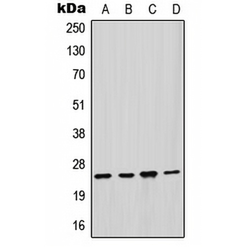 GSTM2 Rabbit Polyclonal Antibody