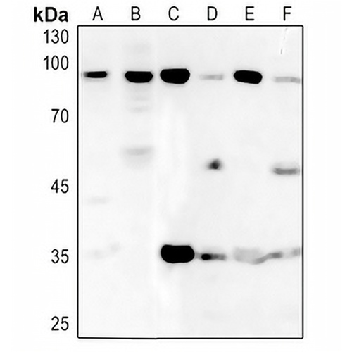 BRF1 Rabbit Polyclonal Antibody