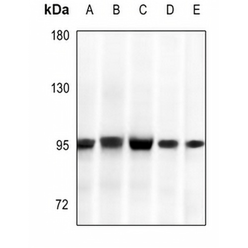GYS1 Rabbit Polyclonal Antibody