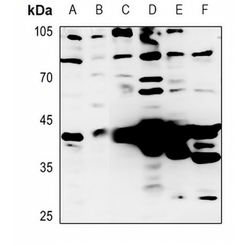 Granzyme B/H Rabbit Polyclonal Antibody