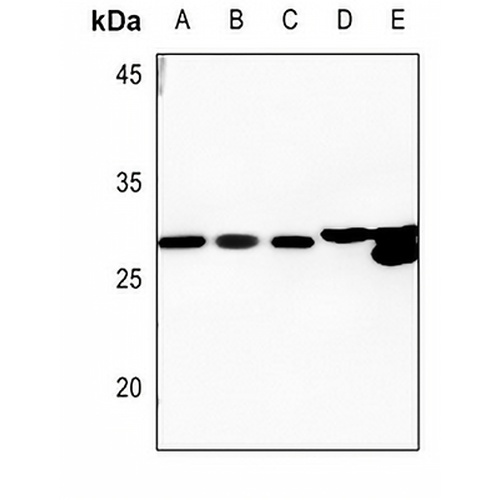 HADH2 Rabbit Polyclonal Antibody