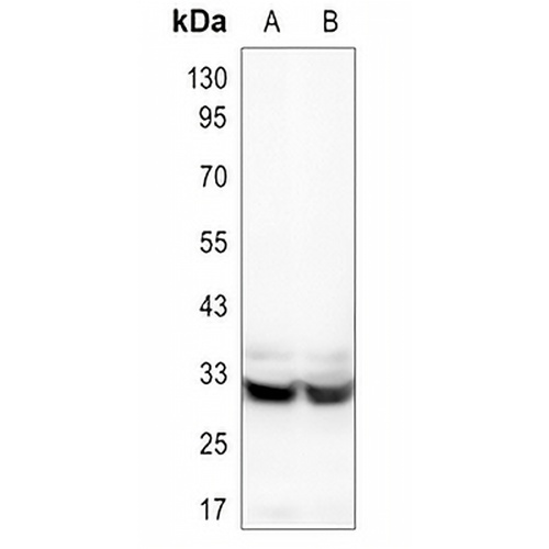 HCCS Rabbit Polyclonal Antibody