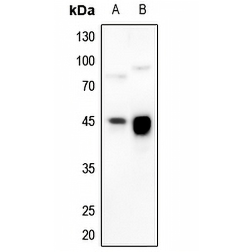 HLA-G Rabbit Polyclonal Antibody