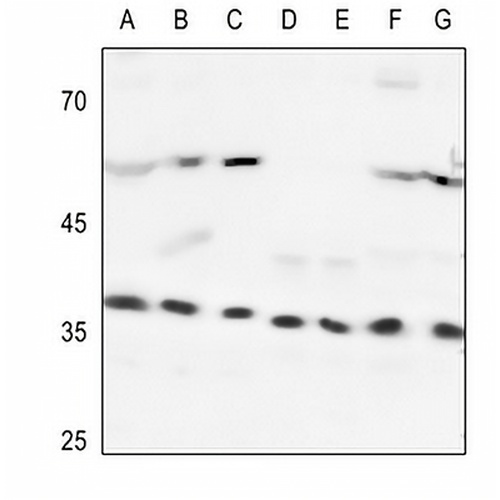 Heme Oxygenase 2 Rabbit Polyclonal Antibody