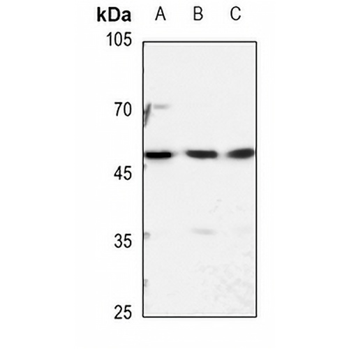 hnRNP H Rabbit Polyclonal Antibody