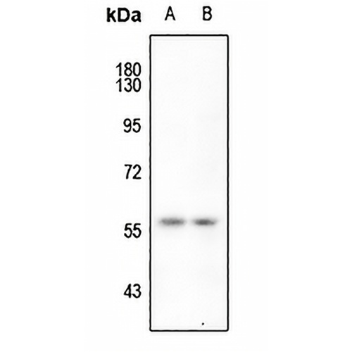 hnRNP K (Phospho-S284) Rabbit Polyclonal Antibody