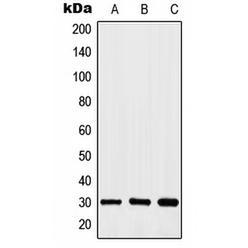 HOXA11/D11 Rabbit Polyclonal Antibody