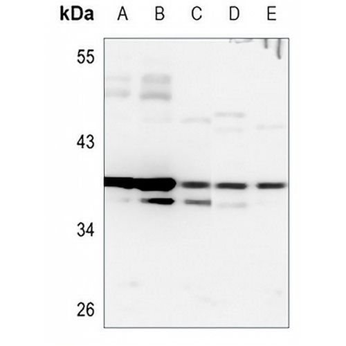 HOXB2 Rabbit Polyclonal Antibody