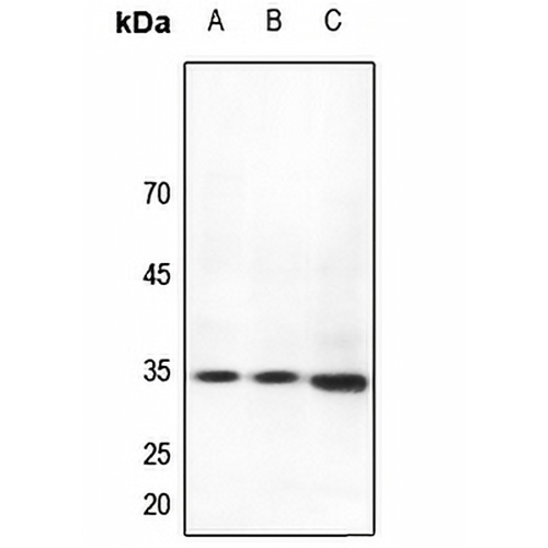HOXB4 Rabbit Polyclonal Antibody