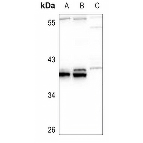 HOXB5 Rabbit Polyclonal Antibody