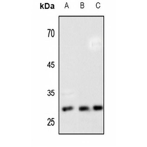 HOXB7 Rabbit Polyclonal Antibody