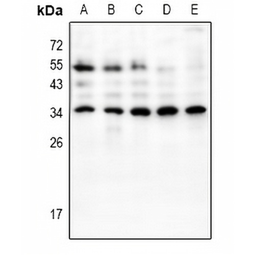 HOXB9 Rabbit Polyclonal Antibody