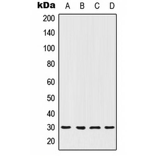 HOXC12 Rabbit Polyclonal Antibody