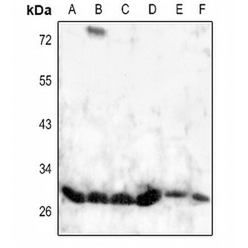 HOXD8 Rabbit Polyclonal Antibody