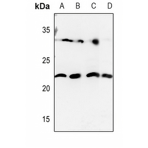 HOXD12 Rabbit Polyclonal Antibody