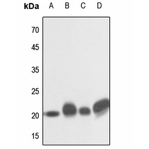 NRAS/HRAS/KRAS Rabbit Polyclonal Antibody