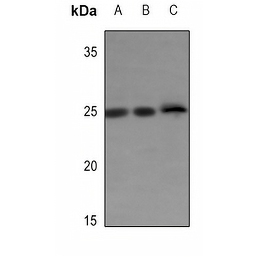 ERAS Rabbit Polyclonal Antibody