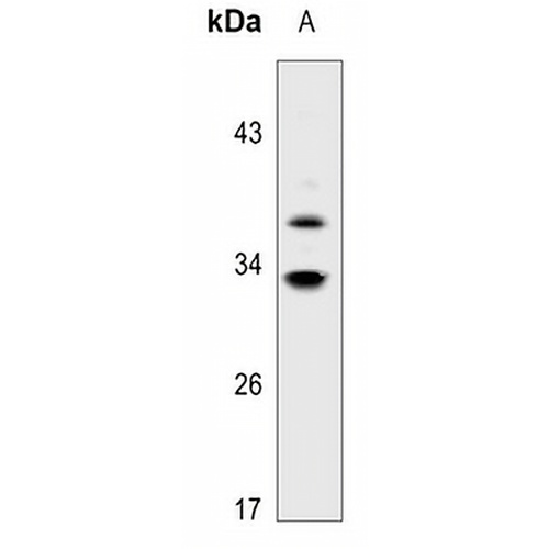 HSD11B1 Rabbit Polyclonal Antibody
