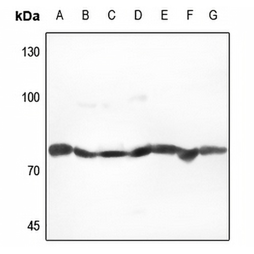 GRP78 Rabbit Polyclonal Antibody