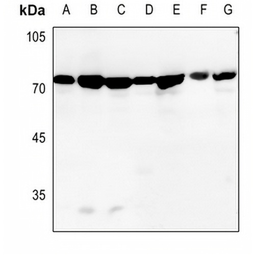 GRP75 Rabbit Polyclonal Antibody