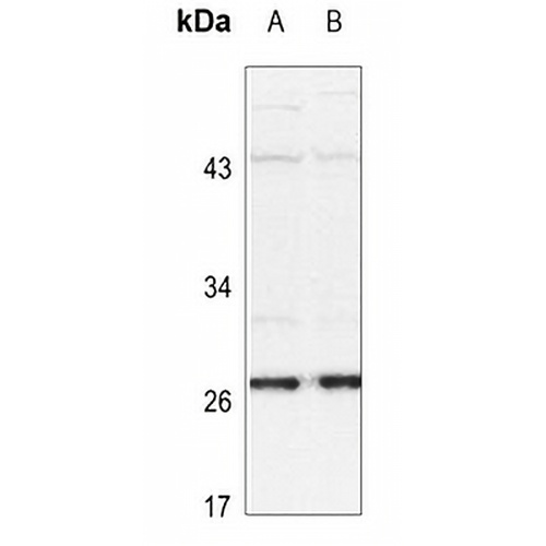 HSP27 (Phospho-S15) Rabbit Polyclonal Antibody