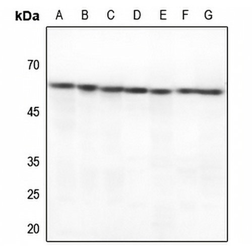 HSP60 Rabbit Polyclonal Antibody