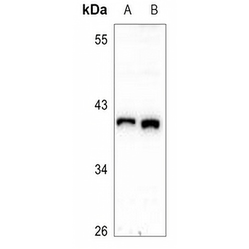 HSP40 Rabbit Polyclonal Antibody