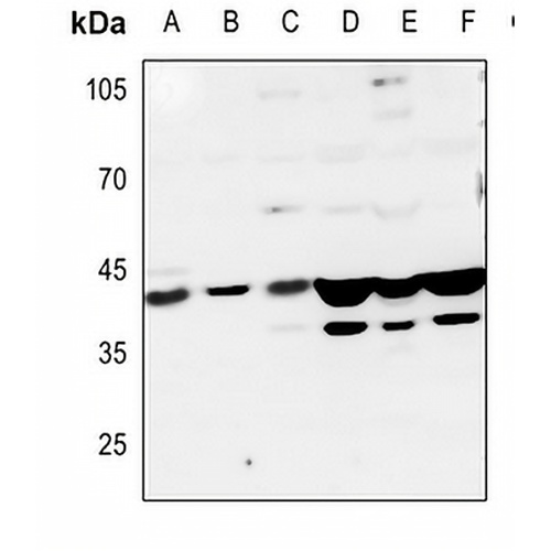 5-HT1D Rabbit Polyclonal Antibody