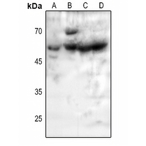 5-HT2B Rabbit Polyclonal Antibody