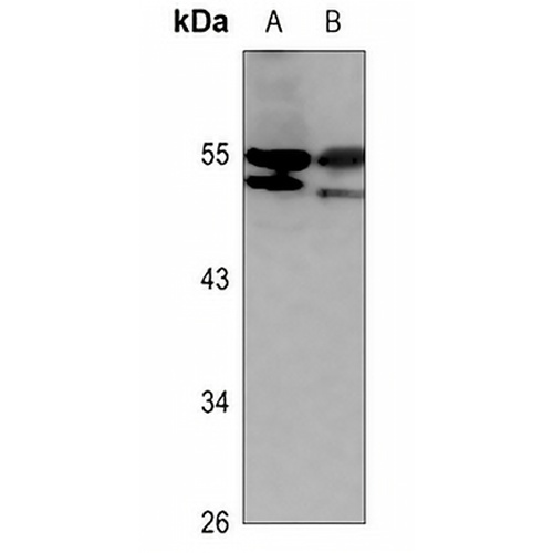 CD102 Rabbit Polyclonal Antibody