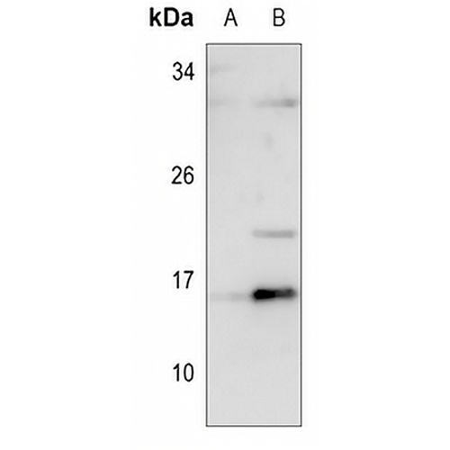 ID1 Rabbit Polyclonal Antibody