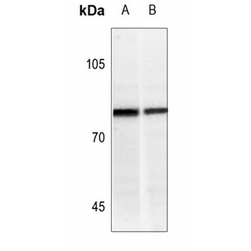 IFNGR1 (Phospho-Y457) Rabbit Polyclonal Antibody