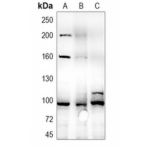 IGF1 Receptor Rabbit Polyclonal Antibody