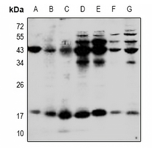 IL-1 beta Rabbit Polyclonal Antibody