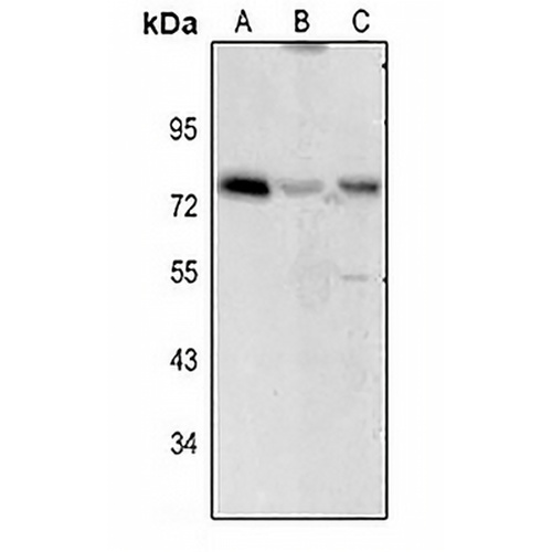 CD122 Rabbit Polyclonal Antibody