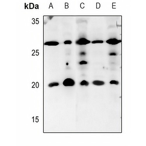 IL-5 Rabbit Polyclonal Antibody
