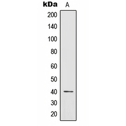 IL-12B Rabbit Polyclonal Antibody