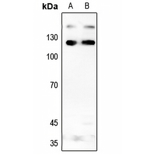 INCENP Rabbit Polyclonal Antibody