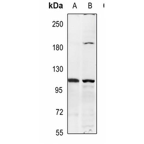 Insulin Receptor Rabbit Polyclonal Antibody