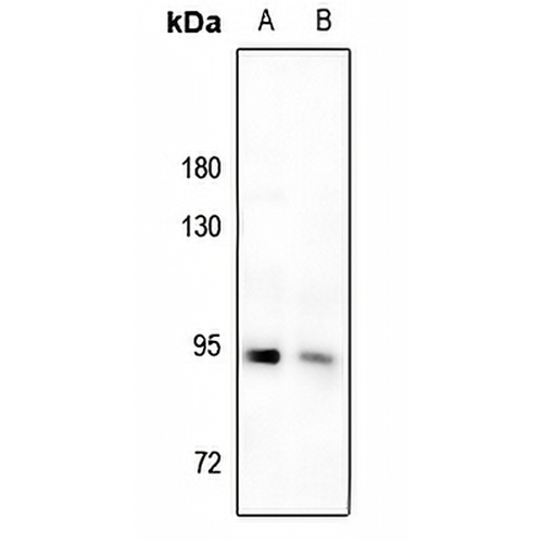 IRAK1 (Phospho-T209) Rabbit Polyclonal Antibody