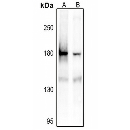 IRS1 (Phospho-S1101) Rabbit Polyclonal Antibody