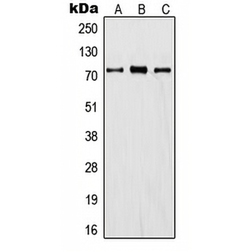 ITIH1 Rabbit Polyclonal Antibody