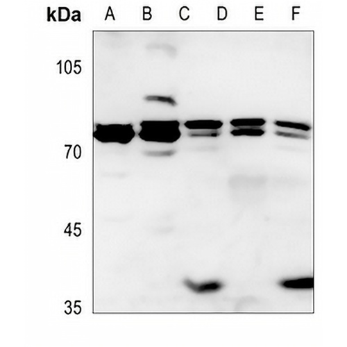 ITPKB Rabbit Polyclonal Antibody