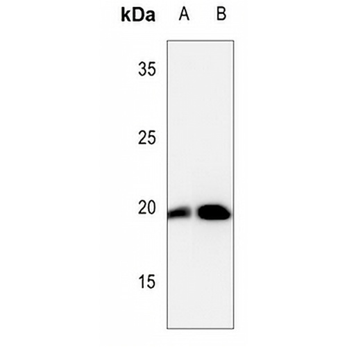 Cofilin (Phospho-S3) Rabbit Polyclonal Antibody